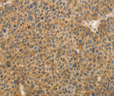 Anti-Human TFPI2 Antibody - ABMIUM