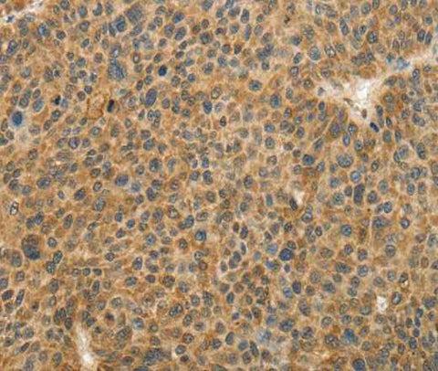 Anti-Human TFPI2 Antibody