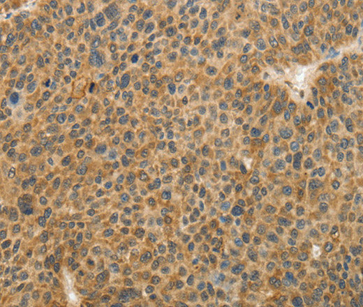 Anti-Human TFPI2 Antibody - ABMIUM