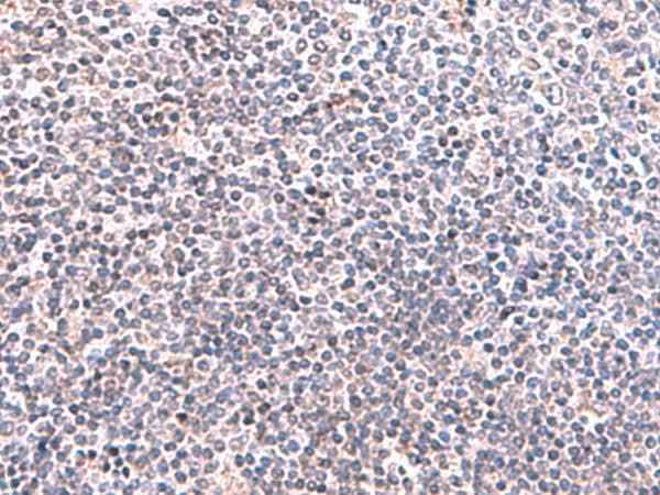 Anti-Human KIR3DL1 Antibody