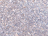 Immunohistochemistry of paraffin-embedded Human tonsil tissue using KIR3DL1 Polyclonal Antibody at dilution of 1:95(×200)