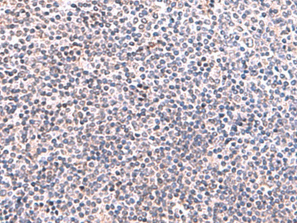 Immunohistochemistry of paraffin-embedded Human tonsil tissue using KIR3DL1 Polyclonal Antibody at dilution of 1:95(×200)