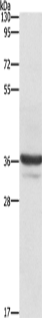 Anti-Human/Mouse/Rat ANXA3 Antibody - ABMIUM