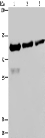 Anti-Human FASTKD2 Antibody - ABMIUM