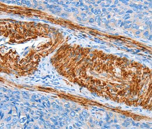 Anti-Human/Rat AARS Antibody