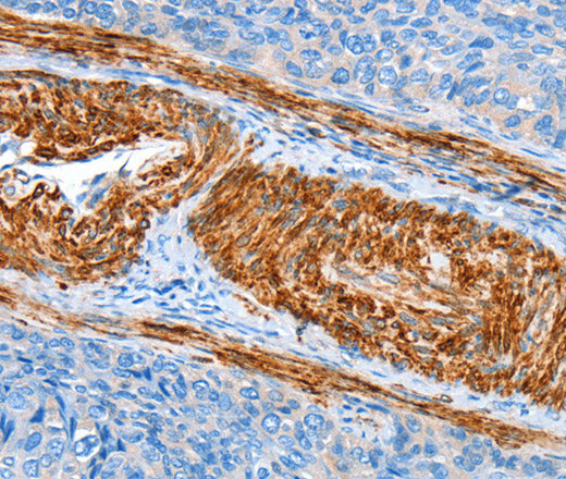 Anti-Human/Rat AARS Antibody - ABMIUM