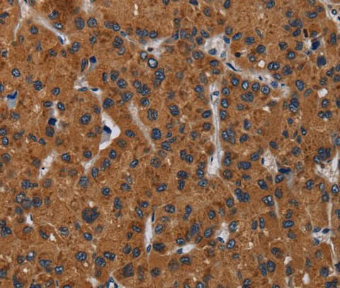 Anti-Human KLK8 Antibody - ABMIUM