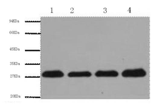 Western Blot analysis of Hela, Rat brain, NIH, 3T3, 293T using Proliferating Cell Nuclear Antigen Monoclonal Antibody at dilution of 1:5000.