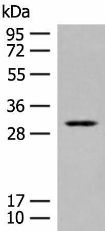 Western blot analysis of Human kidney tissue lysate using TPMT Polyclonal Antibody at dilution of 1:400
