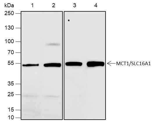 Anti-Human/Rat SLC16A1 Antibody [A653]