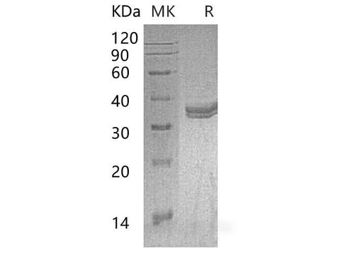 Recombinant Mouse Carbonic Anhydrase 4/CA4 Protein (aa 18-277, His Tag) - ABMIUM