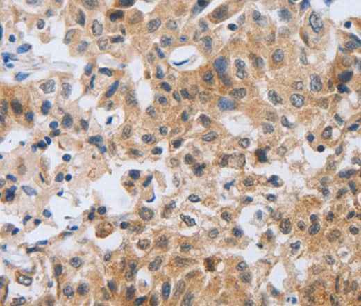 Anti-Human NEB Antibody