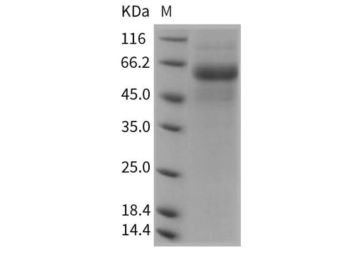 Recombinant Rat DDR2 Kinase/CD167b Protein (His Tag) - ABMIUM