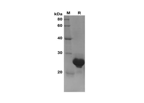 SDS-PAGE analysis of Human HRAS proteins, 2 μg/lane of Recombinant Human HRAS proteins was resolved with SDS-PAGE under reducing conditions, showing bands at 25 kDa.