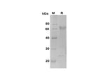 SDS-PAGE analysis of Mouse Osteopontin/OPN proteins, 2 μg/lane of Recombinant Mouse Osteopontin/OPN proteins was resolved with SDS-PAGE under reducing conditions, showing bands at 65 kDa.
