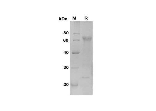 SDS-PAGE analysis of Mouse Osteopontin/OPN proteins, 2 μg/lane of Recombinant Mouse Osteopontin/OPN proteins was resolved with SDS-PAGE under reducing conditions, showing bands at 65 kDa.