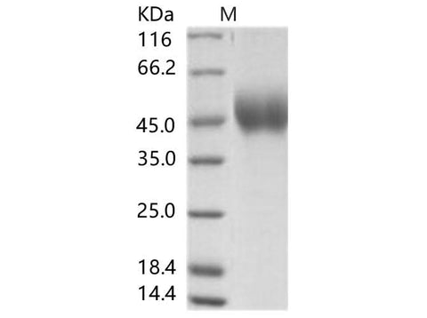 Recombinant EBOV (subtype Zaire, strain Mayinga 1976) GP-RBD / Glycoprotein Protein (His Tag) - ABMIUM