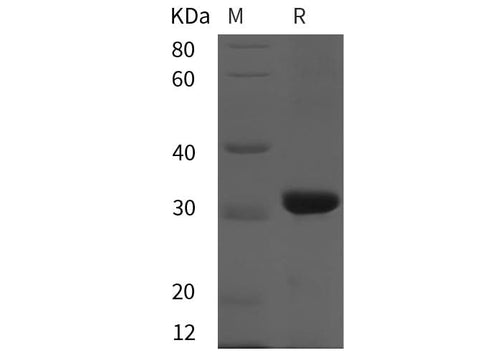 SDS-PAGE analysis of Rat CD38/ADPRC1 proteins, 2 μg/lane of Recombinant Rat CD38/ADPRC1 proteins was resolved with SDS-PAGE under reducing conditions, showing bands at 32 kDa.