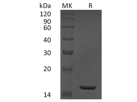 Recombinant Human TNF-alpha/TNFA Protein - ABMIUM