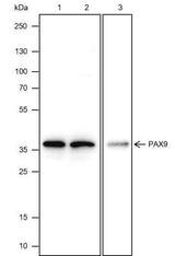 Anti-Human/Rat PAX9 Antibody [A411]