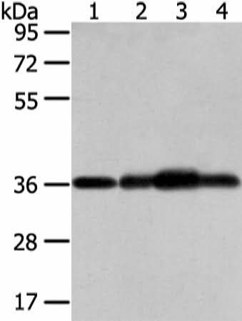 Anti-Human/Mouse/Rat STX12 Antibody - ABMIUM