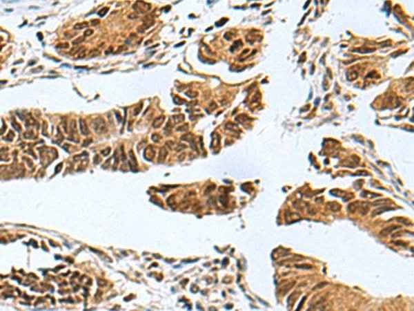 Anti-Human/Mouse PDCD5 Antibody