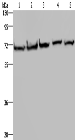 Anti-Human/Mouse/Rat HSPA9 Antibody - ABMIUM