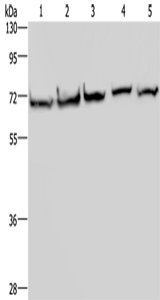 Anti-Human/Mouse/Rat HSPA9 Antibody - ABMIUM