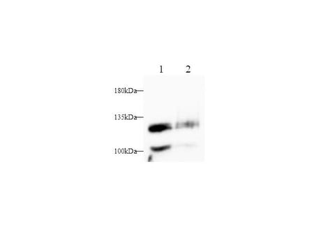 Anti-Human CD146/MCAM Antibody - ABMIUM