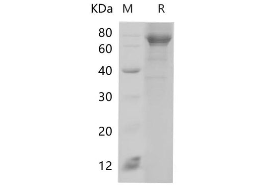 SDS-PAGE analysis of Human HSPA1A proteins, 2 μg/lane of Recombinant Human HSPA1A proteins was resolved with SDS-PAGE under reducing conditions, showing bands at 72.2 kDa.