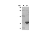 SDS-PAGE analysis of Human MIF proteins, 2 μg/lane of Recombinant Human MIF proteins was resolved with SDS-PAGE under reducing conditions, showing bands at 32 kDa.
