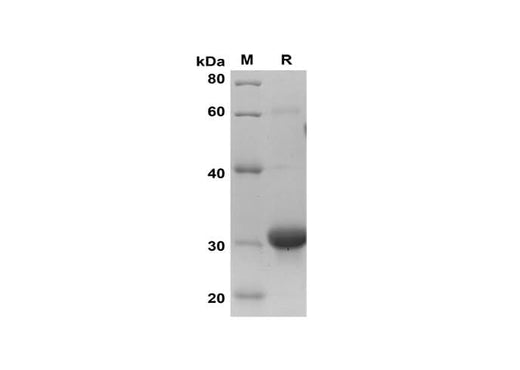 SDS-PAGE analysis of Human MIF proteins, 2 μg/lane of Recombinant Human MIF proteins was resolved with SDS-PAGE under reducing conditions, showing bands at 32 kDa.