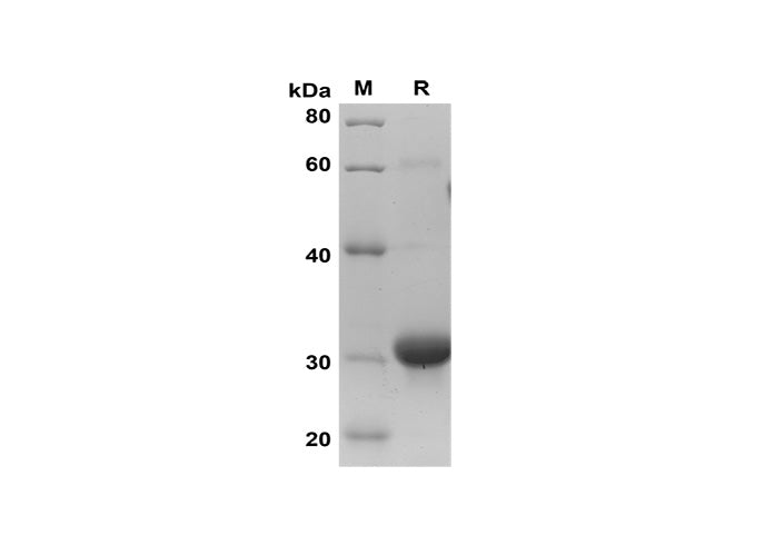 SDS-PAGE analysis of Human MIF proteins, 2 μg/lane of Recombinant Human MIF proteins was resolved with SDS-PAGE under reducing conditions, showing bands at 32 kDa.