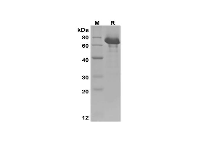 SDS-PAGE analysis of Human IGF-1/HSA Fusion Protein, 2 μg/lane of Recombinant Human IGF-1/HSA Fusion Protein was resolved with SDS-PAGE under reducing conditions, showing bands at 70 kDa.