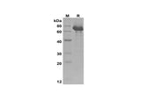 SDS-PAGE analysis of Human IGF-1/HSA Fusion Protein, 2 μg/lane of Recombinant Human IGF-1/HSA Fusion Protein was resolved with SDS-PAGE under reducing conditions, showing bands at 70 kDa.