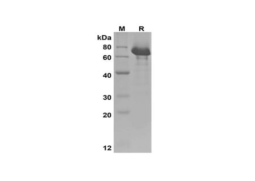 SDS-PAGE analysis of Human IGF-1/HSA Fusion Protein, 2 μg/lane of Recombinant Human IGF-1/HSA Fusion Protein was resolved with SDS-PAGE under reducing conditions, showing bands at 70 kDa.