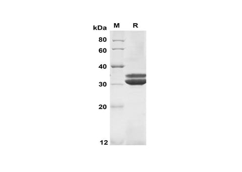 SDS-PAGE analysis of Human CCL13 proteins, 2 μg/lane of Recombinant Human CCL13 proteins was resolved with SDS-PAGE under reducing conditions, showing bands at 31 kDa.