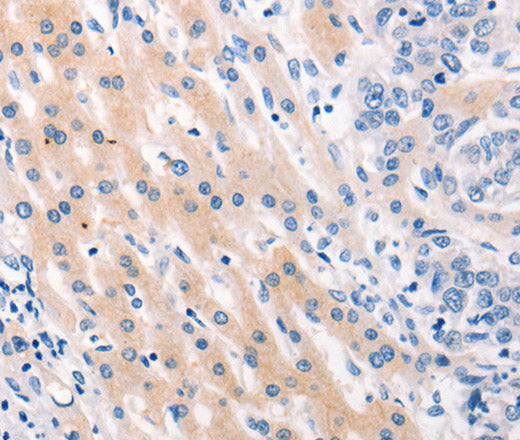 Anti-Human MUC2 Antibody - ABMIUM