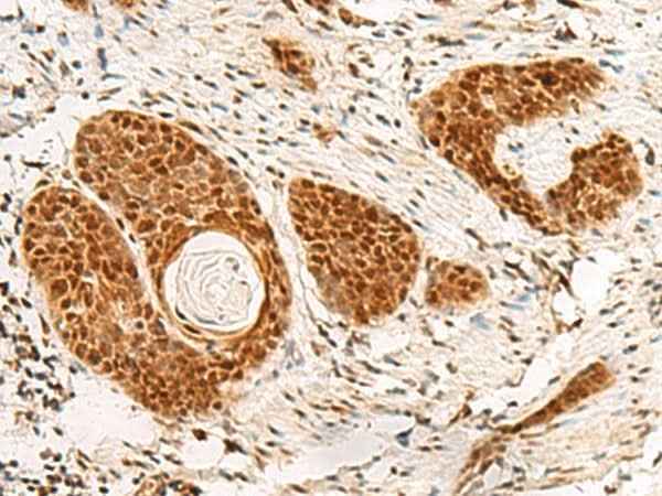 Anti-Human POM121 Antibody