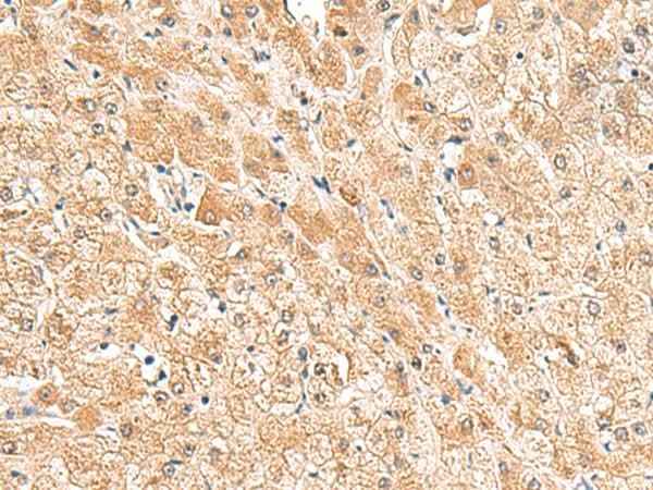 Anti-Human/Mouse/Rat TRUB1 Antibody