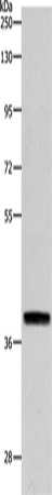 Anti-Human/Mouse/Rat RTN4 Antibody - ABMIUM