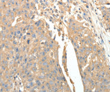 Anti-Human SFTPD Antibody - ABMIUM