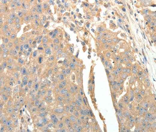 Anti-Human SFTPD Antibody