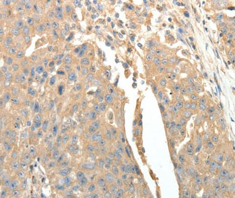 Anti-Human SFTPD Antibody - ABMIUM