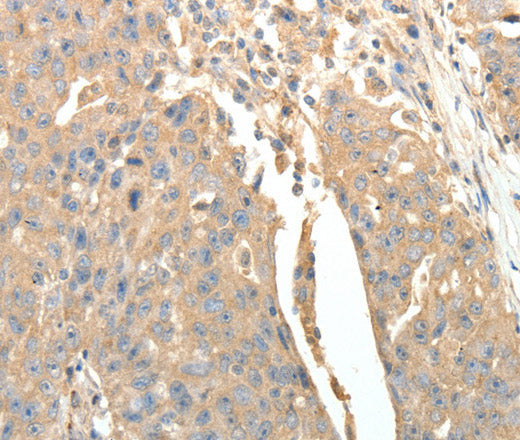 Anti-Human SFTPD Antibody - ABMIUM