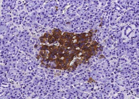 Anti-Human IGFBP7 Antibody [A1175] - ABMIUM