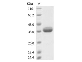 Recombinant SARS-CoV-2 Spike RBD(Q414R)(His Tag) - ABMIUM