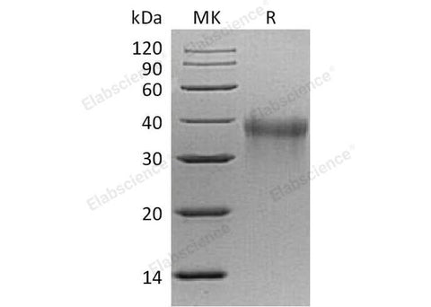 Recombinant Mouse TREM1 Protein (His Tag) - ABMIUM