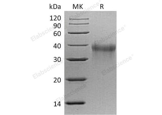 Recombinant Mouse TREM1 Protein (His Tag) - ABMIUM