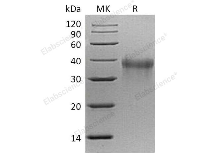 Recombinant Mouse TREM1 Protein (His Tag) - ABMIUM